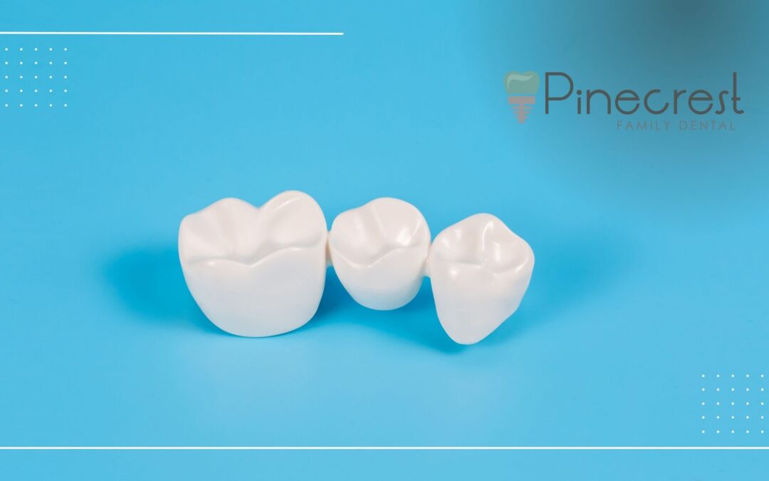 dental crowns